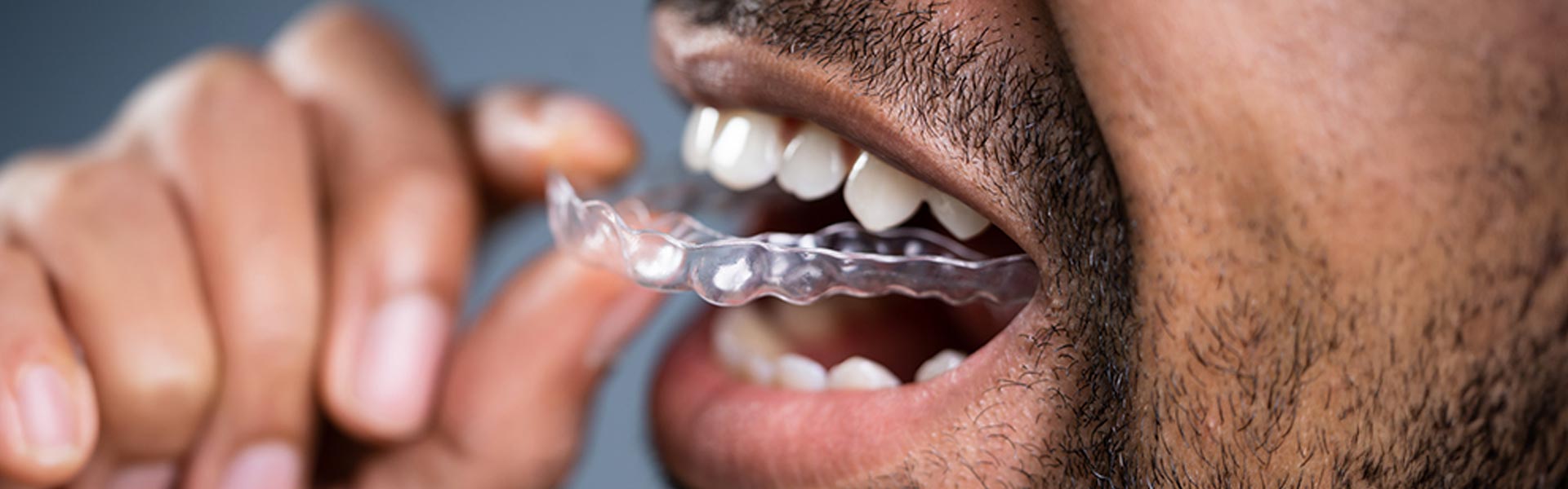Fun Mouth Guard Facts