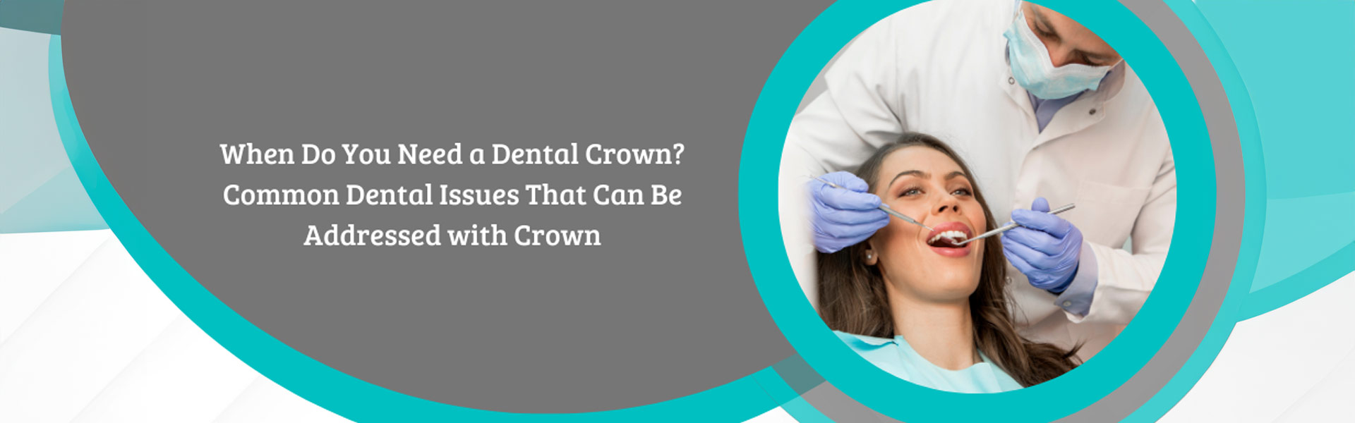 Understanding What Dental Crowns Are and When You Need Them