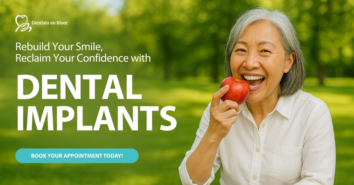 Dental Implants